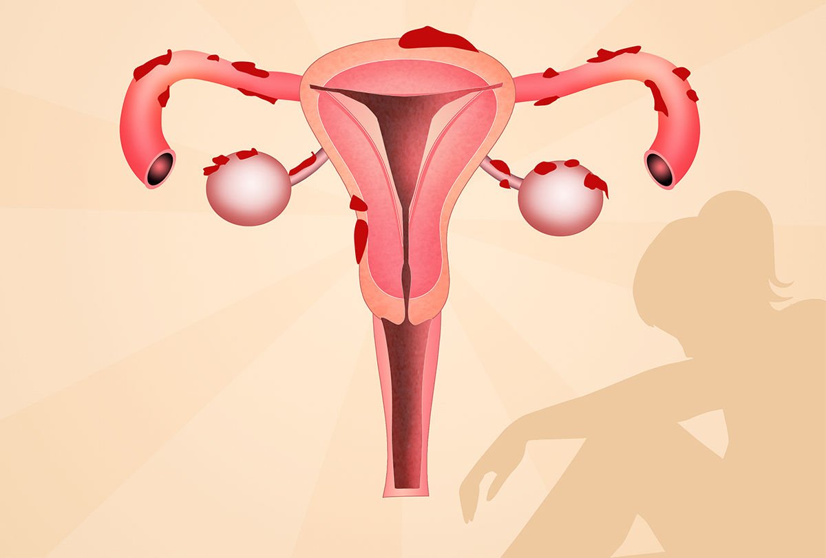 Gynecologist in Dhanori