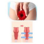 Gynecologist in Viman nagar