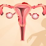 Gynecologist in Dhanori